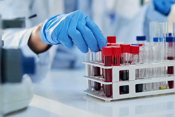 Estudios médicos preventivos